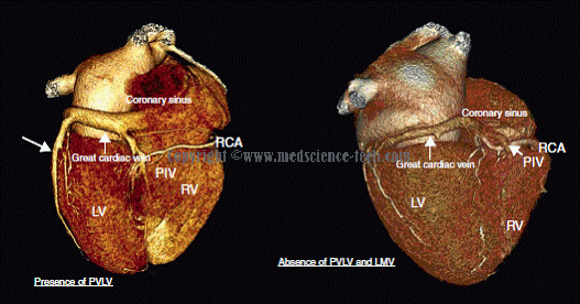 心脏磁共振成像（CMR）可有效评估多种心血管疾病